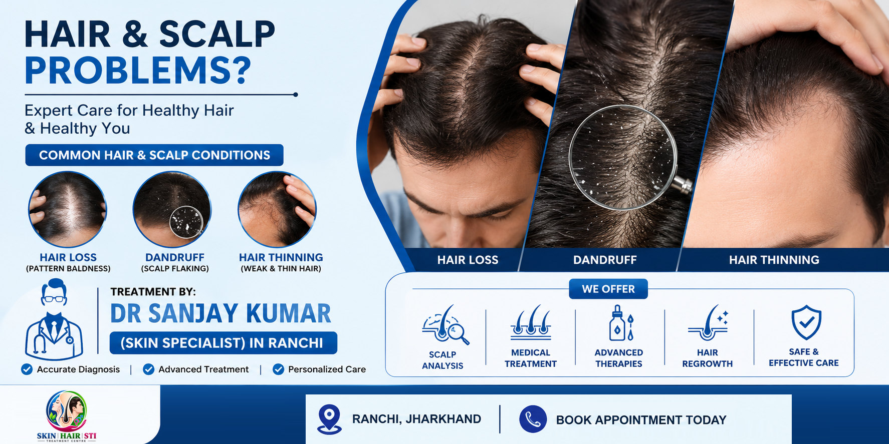 Hair & Scalp Disease Treatment in Ranchi by Dr. Sanjay Kumar